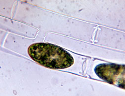 Spirogyra